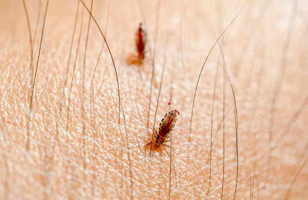 Lice Life Cycle How Long Do Head Lice Live? LiceDoctors